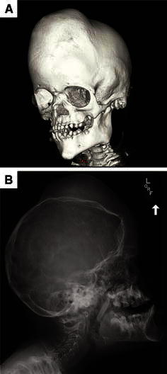 Fig. 6