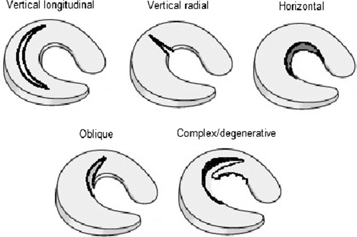 Fig. 3