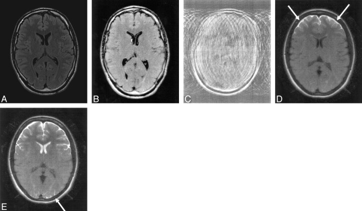 Fig 1.