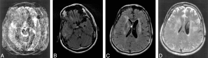 Fig 5.