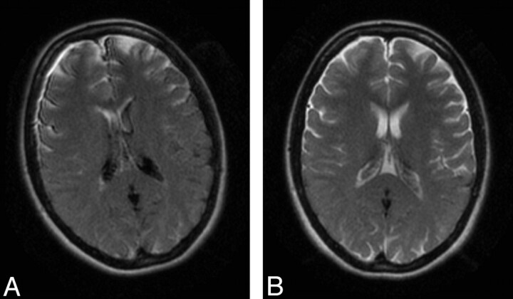 Fig 2.