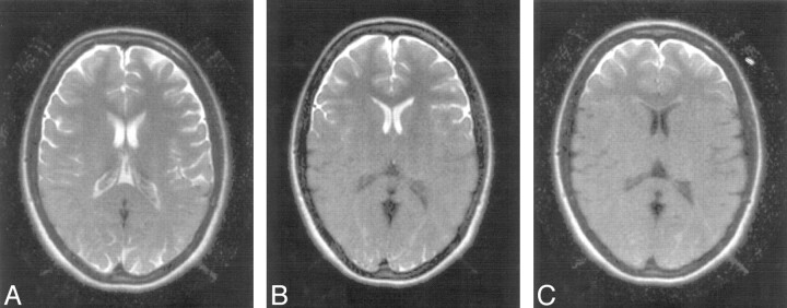 Fig 3.