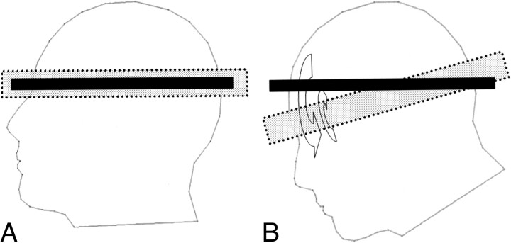 Fig 6.