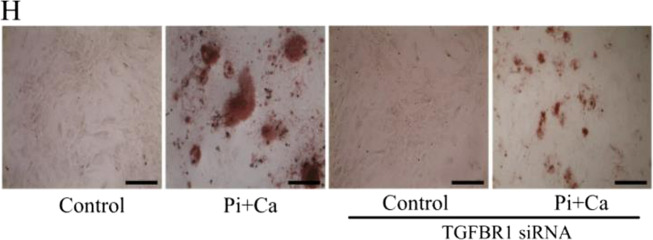 graphic file with name 42003_2020_1414_Fig1_HTML.jpg