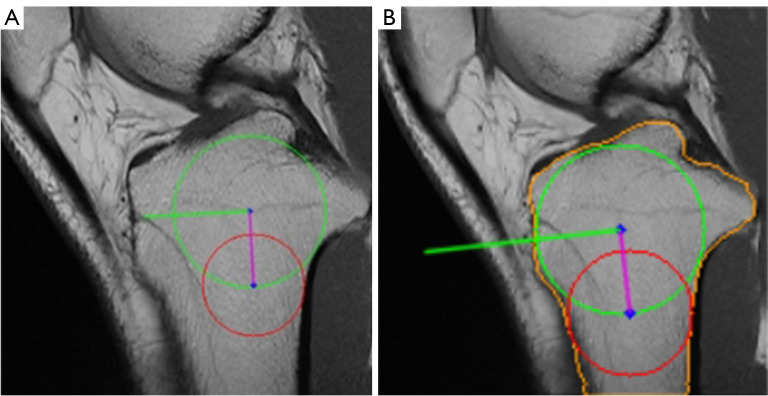 Figure 23