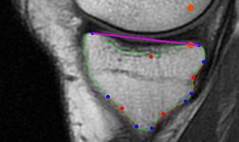 Figure 15