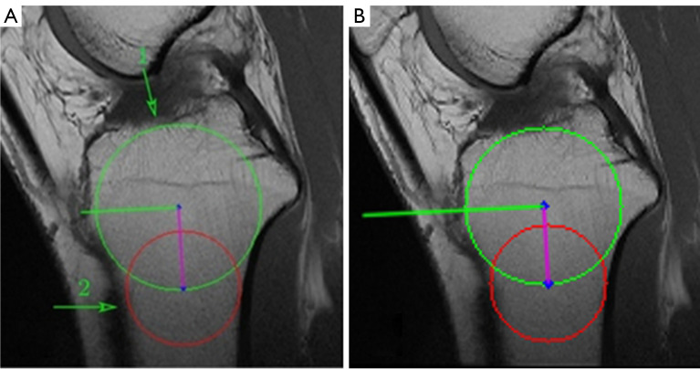 Figure 21