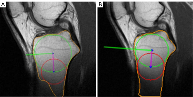 Figure 22