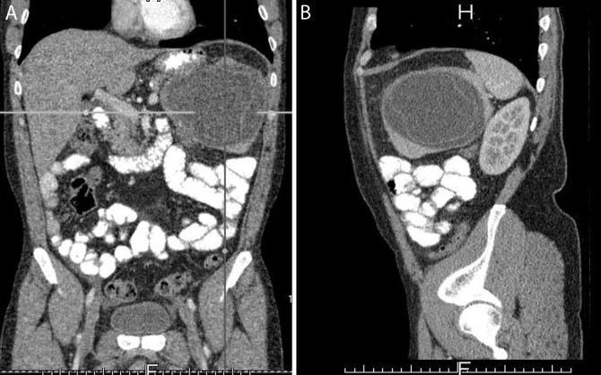 Fig. 2