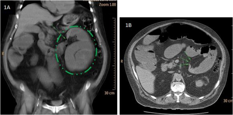 Fig. 1