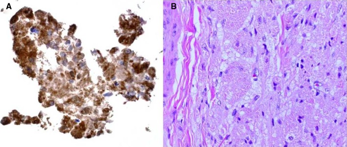 Fig. 1