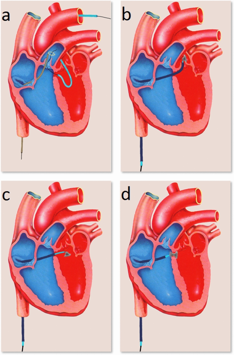 Fig. 2