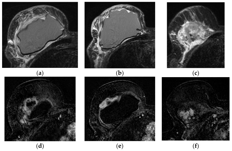 Figure 19