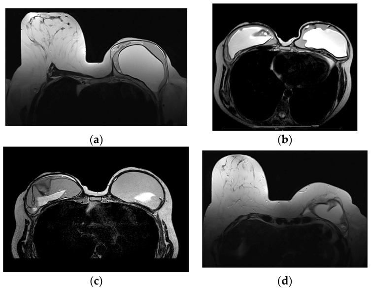 Figure 16