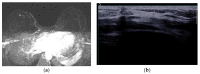 Figure 20