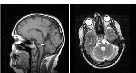 Fig 2a & b.