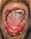 Fig. 2