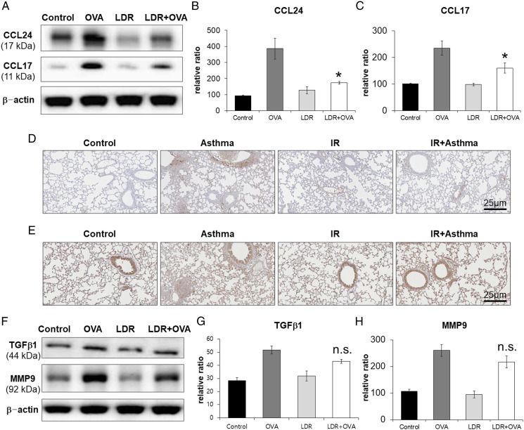 Low dose rate radiation regulates m2 like macrophages in an allergic