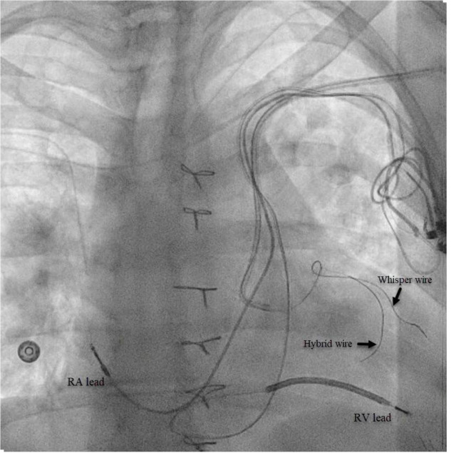 Figure 2.