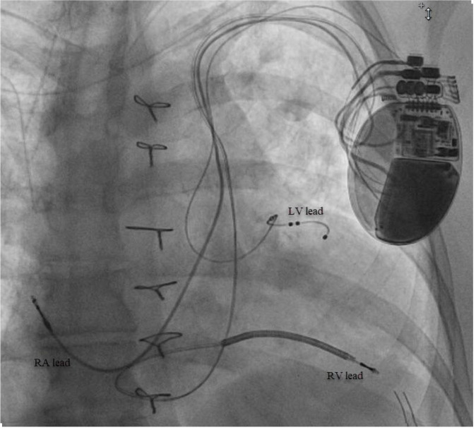 Figure 3.