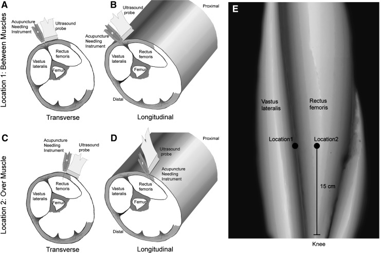 FIG. 1.