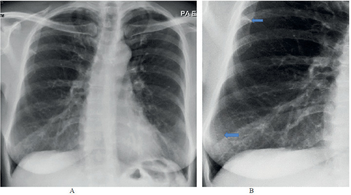 Figure 4.