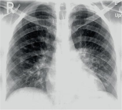 Figure 13.