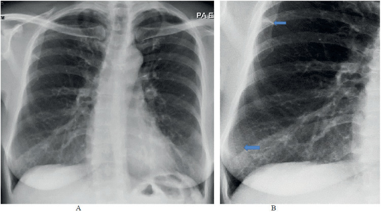 Figure 5.