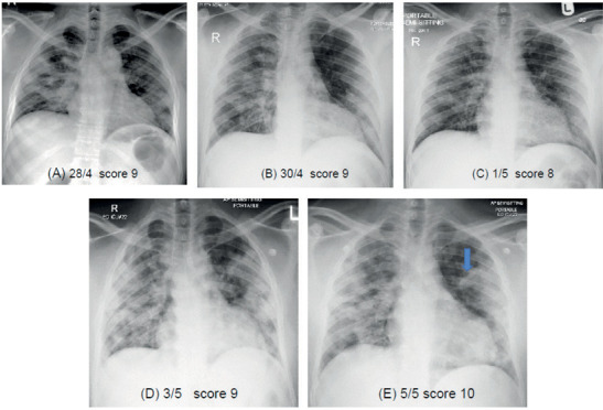 Figure 15.