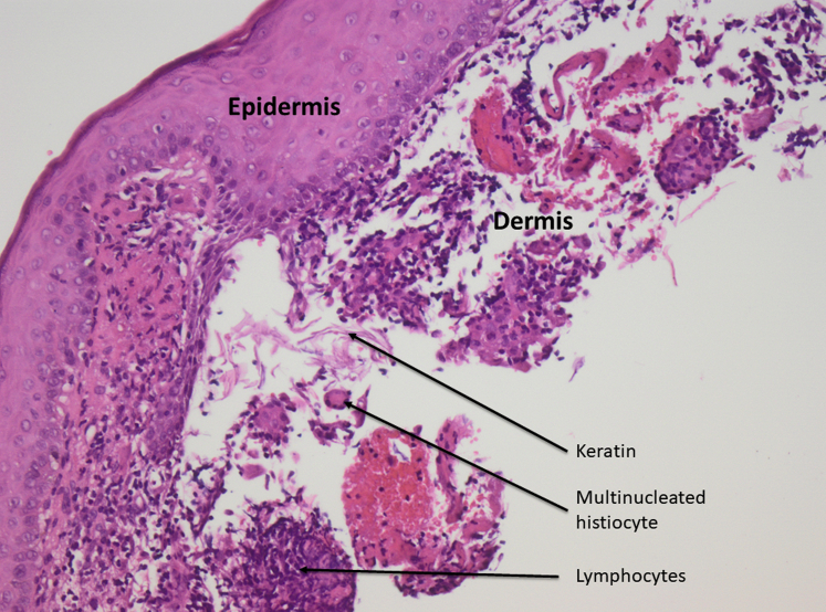 Fig 3