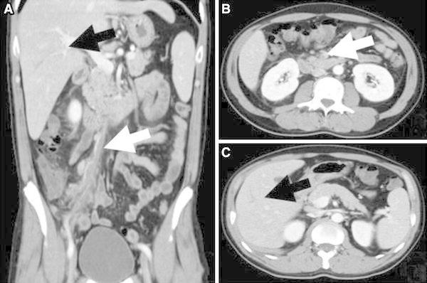 Fig. 2