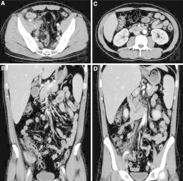 Fig. 1