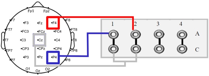 FIGURE 4