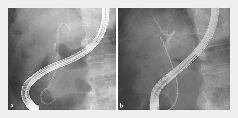 Fig. 2