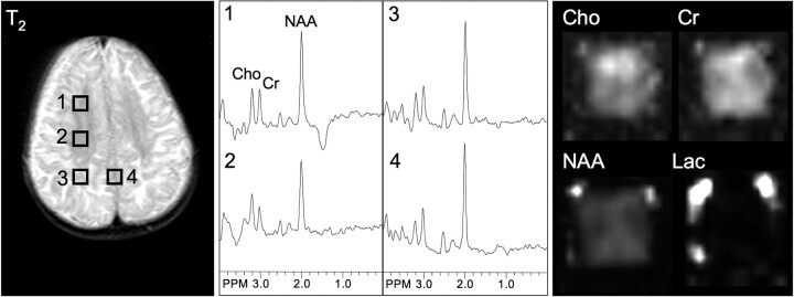 Fig 4.