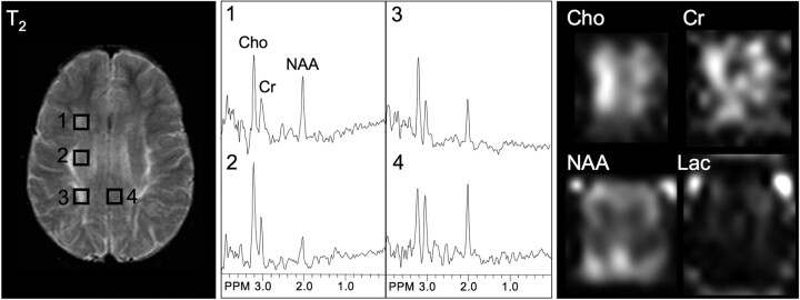 Fig 3.