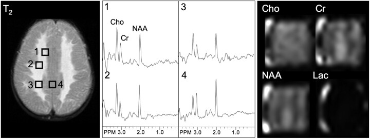 Fig 2.