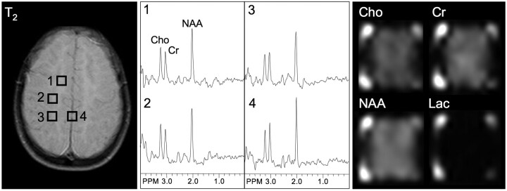 Fig 1.