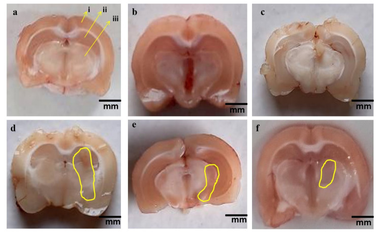 Figure 16