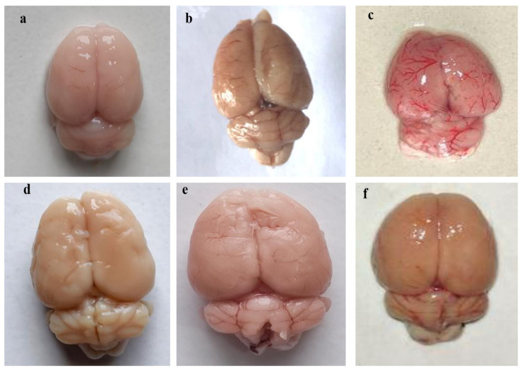 Figure 15