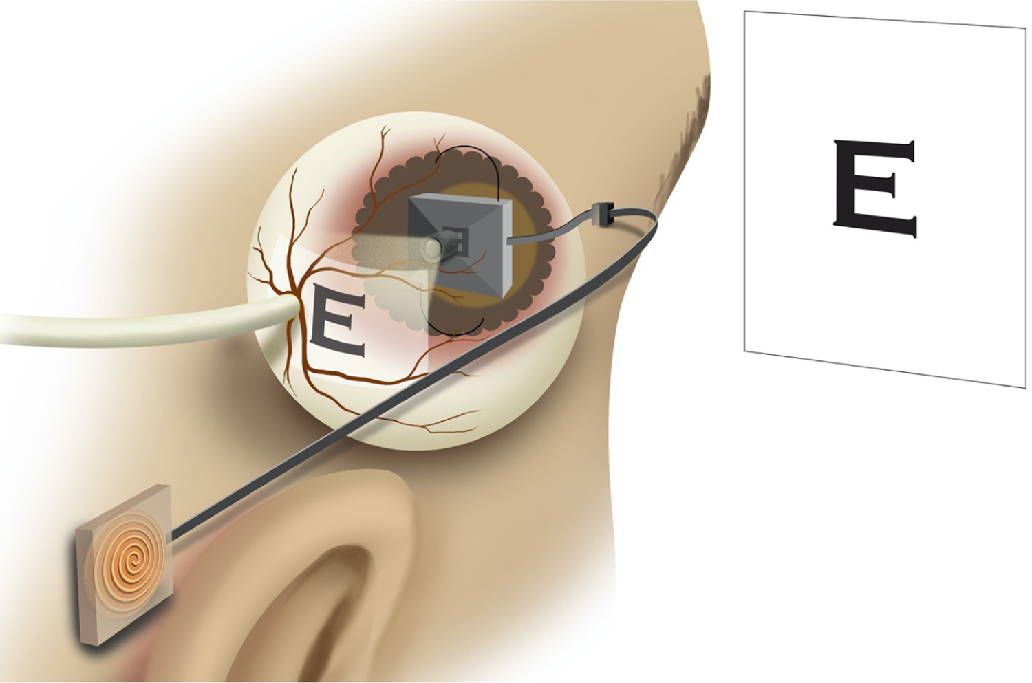 Figure 1: