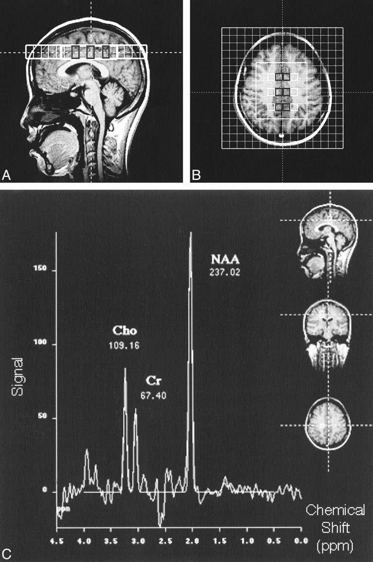 fig 1.