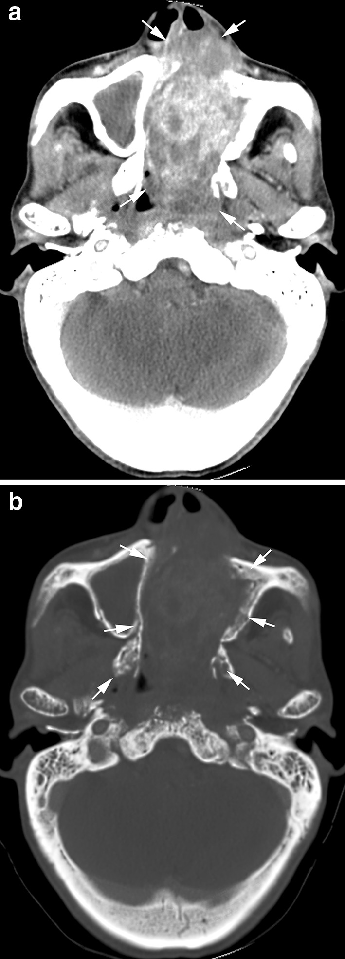 Fig. 6