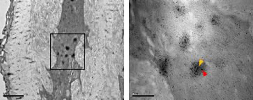 The 'ins' and 'outs' of podosomes and invadopodia: characteristics ...