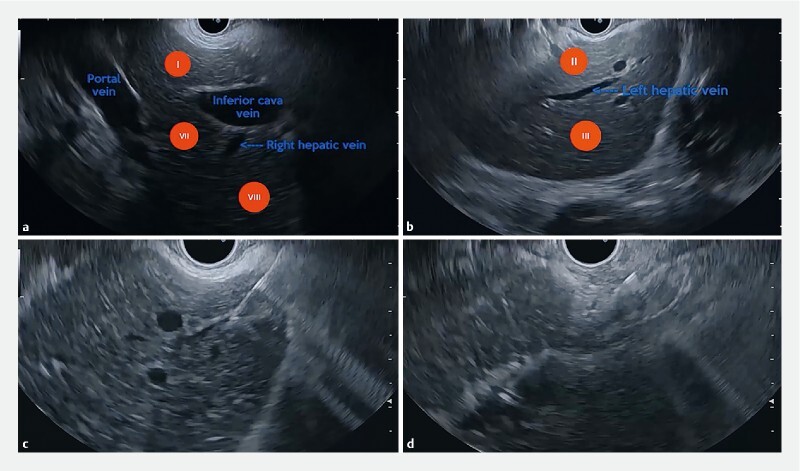 Fig. 2