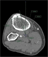 Fig. 6