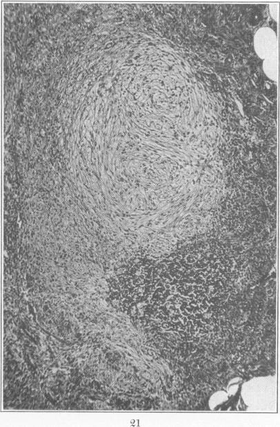 Fig. 21