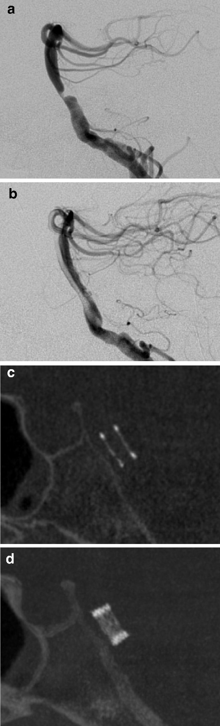 Fig. 1