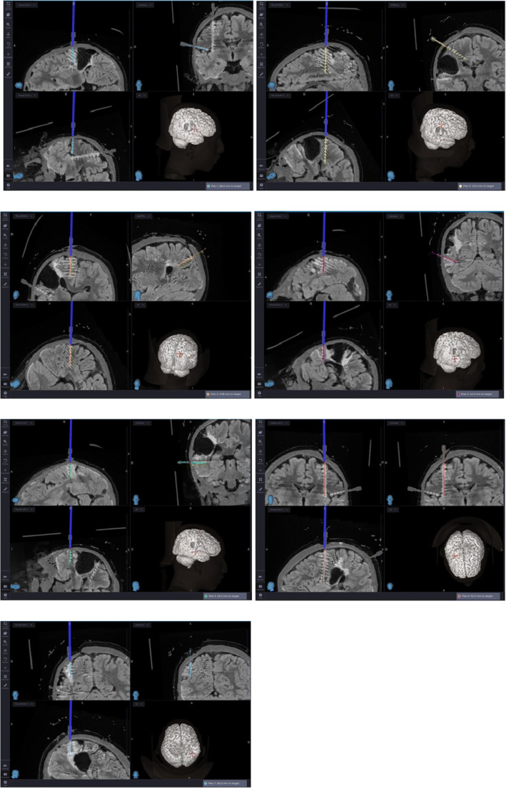 Fig. 3