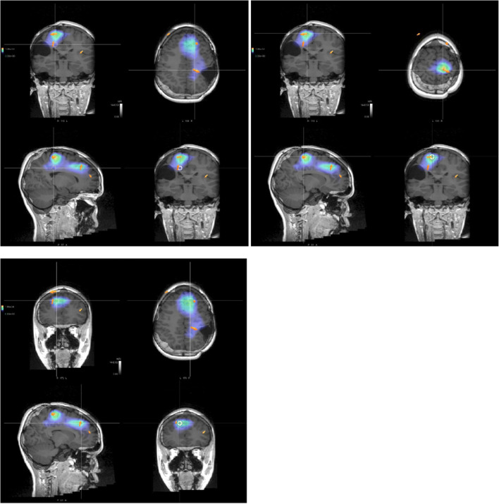 Fig. 2